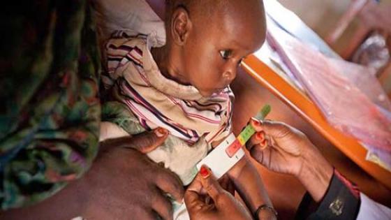 جهود سعودية متواصلة للمساهمة في تغذية الأطفال اليمنيين